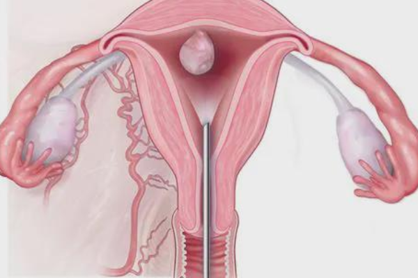 胚胎移植后腹水严重要重视！对胎儿发育的影响不可小觑