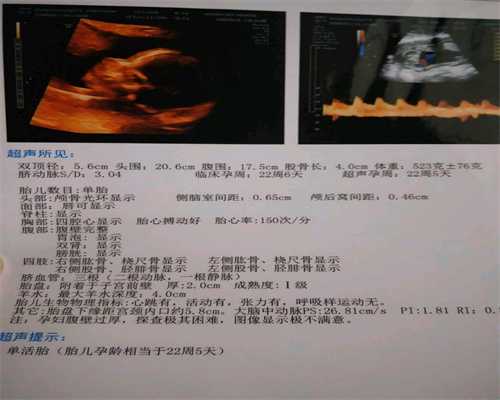 上海代孕怎么样_代孕产子价格介绍_代孕最最便宜
