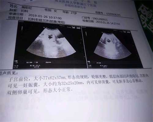 上海代孕中介_上海代怀孕方案_代怀孕三甲医院