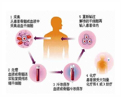 上海代怀孕双胞胎_妊娠糖尿病怎么办 3种方法巧治疗