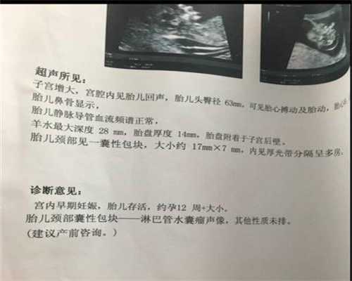上海代孕合法的国家_备孕期间的那些黑色禁忌