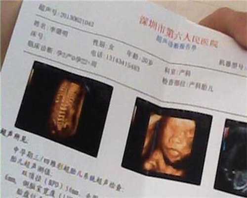上海助代孕包成功_北京玛丽妇婴医院专家提示：夏季妇科多发疾病排行榜