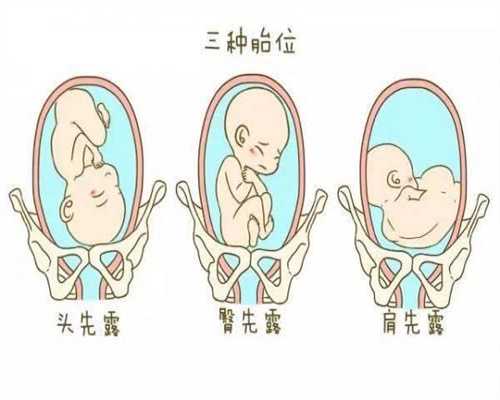 上海2020代怀孕价格_小腹酸痛是怀孕还是月经