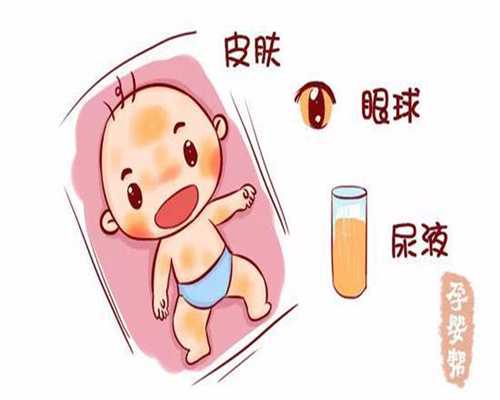 上海代孕一个男孩多少钱_孕囊有卵黄囊说明什么