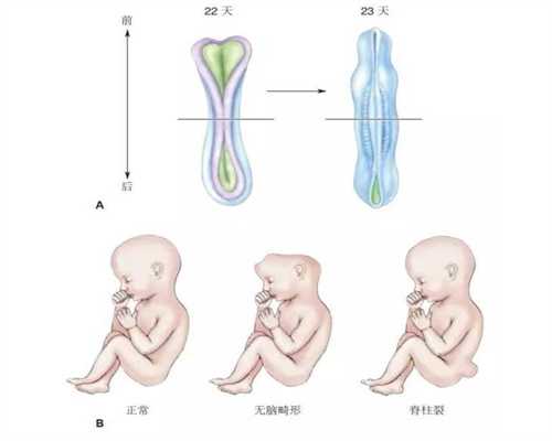 上海代孕2年内抱孩子_孕期小腿抽筋怎么办 热敷可缓解肌肉痉挛
