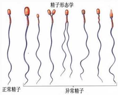 上海代怀孕助孕价格_春季备孕要做好这几个准备