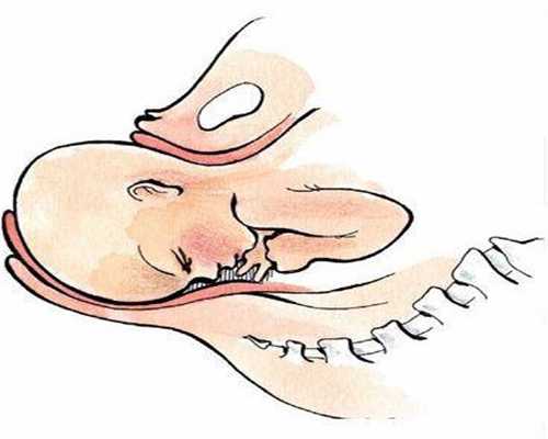 上海代孕产子的过程和方式_4种胎位易难产