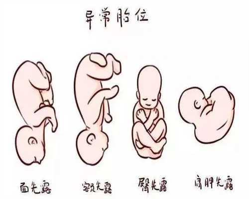 上海代孕手术得多少钱_宝宝拉肚子能喝奶粉吗