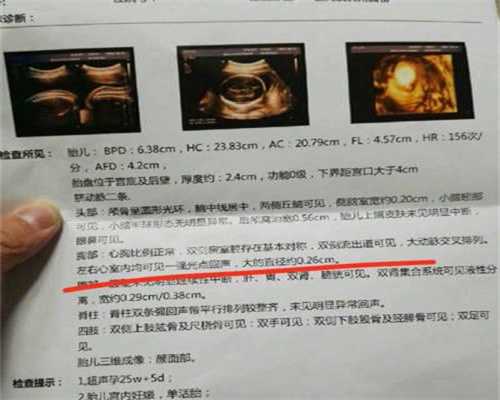 上海医院代孕多少钱_孕妇可以吃杏仁吗