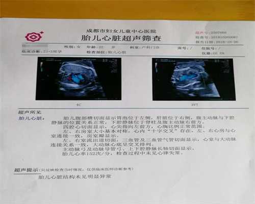 上海代孕一般多少钱_喂奶乳房痛怎么办
