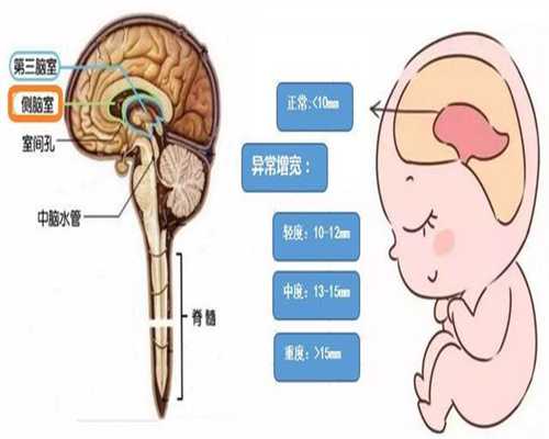 上海代孕在线预约_6岁男孩隔几钟就往厕所里跑,家长以为是吃坏肚子,医生-来晚