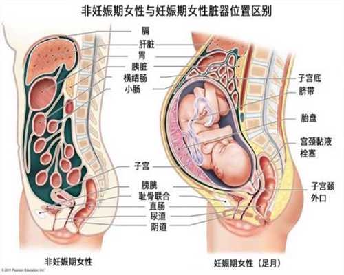 上海找代孕的人