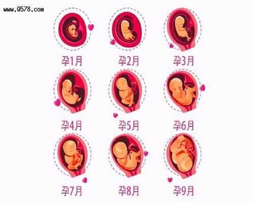 上海代孕代生孩子包成功多少钱_自然流产初期症状有哪些