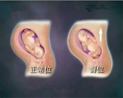上海哪里有代孕