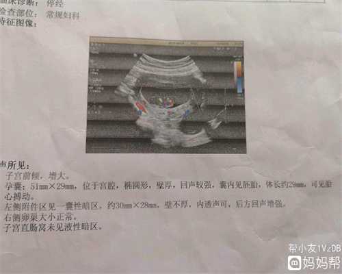 上海代孕在线咨询_代孕网联系方式_代孕圆梦天使价格
