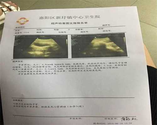 上海代孕包性别