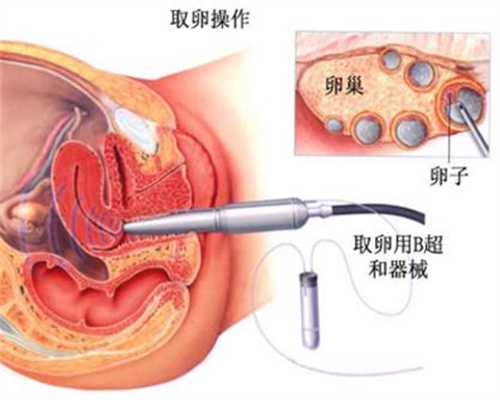 上海代孕包成功套餐_上海哪有愿意代孕的个人_俄罗斯试管婴儿双胞胎流程